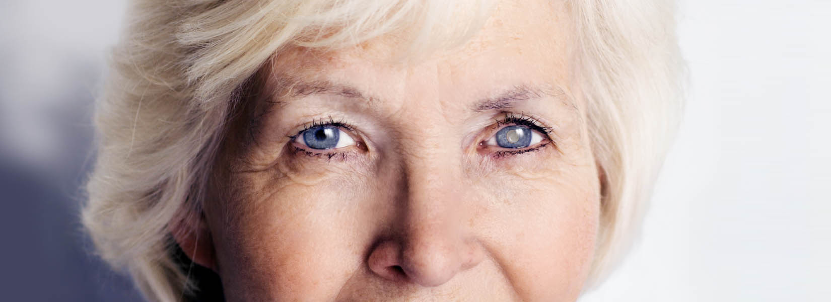 Cataract Surgery in Florissant
