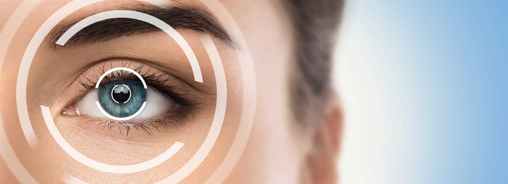 LASIK & Refractive Surgery Co-Management in Florissant